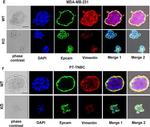 Rabbit IgG (H+L) Cross-Adsorbed Secondary Antibody in Immunocytochemistry (ICC/IF)