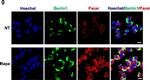 Mouse IgG (H+L) Secondary Antibody in Immunocytochemistry (ICC/IF)