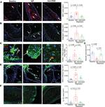 Arginase 1 Antibody in Immunohistochemistry (IHC)