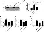 ALPK3 Antibody in Western Blot (WB)