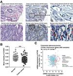 CD163 Antibody in Immunohistochemistry (IHC)