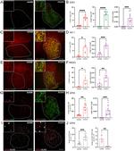 PRDX5 Antibody in Immunohistochemistry (IHC)