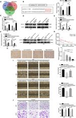 ACOT12 Antibody in Western Blot, Immunohistochemistry (WB, IHC)