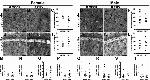 IBA1 Antibody in Immunohistochemistry (IHC)