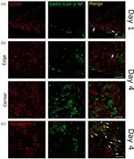 Aquaporin 1 Antibody in Immunohistochemistry (PFA fixed) (IHC (PFA))