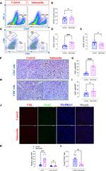 FOXP3 Antibody in Immunohistochemistry (IHC)