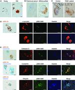 Alpha-synuclein Antibody in Immunohistochemistry (IHC)