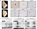 Alpha-synuclein Antibody in Immunohistochemistry (IHC)