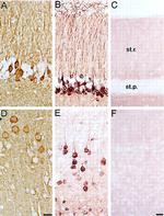 Alpha-synuclein Antibody in Immunohistochemistry (IHC)