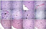 Bcl-2 Antibody in Immunohistochemistry (IHC)