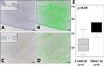 CD34 Antibody in Immunohistochemistry (IHC)