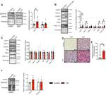 SERCA2 ATPase Antibody in Western Blot (WB)