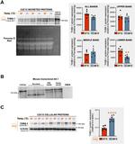 Thrombospondin 1 Antibody in Western Blot (WB)