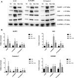 NLRP3 Antibody in Western Blot (WB)