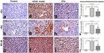 TGF beta-1 Antibody in Immunohistochemistry (IHC)