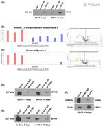 Caveolin 1 Antibody in Western Blot, Immunoprecipitation (WB, IP)