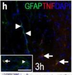 Rabbit IgG (H+L) Highly Cross-Adsorbed Secondary Antibody in Immunohistochemistry (IHC)