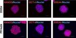 Rabbit IgG (H+L) Highly Cross-Adsorbed Secondary Antibody in Immunocytochemistry (ICC/IF)