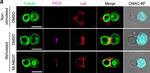 Goat IgG (H+L) Cross-Adsorbed Secondary Antibody in Immunocytochemistry (ICC/IF)