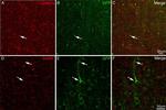 Rabbit IgG (H+L) Highly Cross-Adsorbed Secondary Antibody in Immunocytochemistry (ICC/IF)