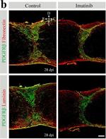 Rabbit IgG (H+L) Highly Cross-Adsorbed Secondary Antibody in Immunohistochemistry (IHC)