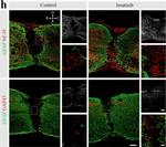 Rabbit IgG (H+L) Highly Cross-Adsorbed Secondary Antibody in Immunohistochemistry (IHC)