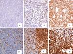 CD44 Antibody in Immunohistochemistry (IHC)