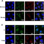 Mouse IgG (H+L) Cross-Adsorbed Secondary Antibody in Immunocytochemistry (ICC/IF)