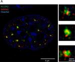 Rabbit IgG (H+L) Secondary Antibody in Immunocytochemistry (ICC/IF)