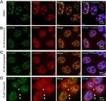 Rabbit IgG (H+L) Secondary Antibody in Immunocytochemistry (ICC/IF)