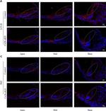 Rabbit IgG (H+L) Secondary Antibody in Immunohistochemistry (Paraffin) (IHC (P))