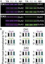 GluR3 Antibody in Western Blot (WB)