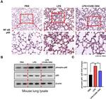 NFkB p65 Antibody in Immunohistochemistry (IHC)