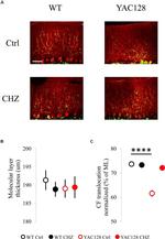 VGLUT2 Antibody in Immunohistochemistry (IHC)