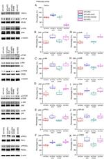 Phospho-JNK1/JNK2 (Thr183, Tyr185) Antibody in Western Blot (WB)