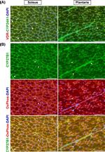 ATP5A1 Antibody in Immunohistochemistry (IHC)