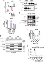 Glucagon Receptor Antibody in Western Blot (WB)