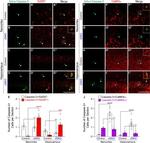 CaMKII alpha Antibody in Immunohistochemistry (IHC)