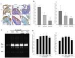 MMP9 Antibody in Immunohistochemistry (IHC)