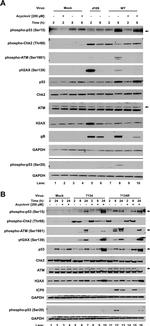 Phospho-p53 (Ser20) Antibody in Western Blot (WB)