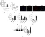 SEPT6 Antibody in Immunocytochemistry (ICC/IF)