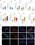 SPRR1B Antibody in Immunohistochemistry (Paraffin) (IHC (P))