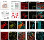 Cytokeratin 18 Antibody in Immunohistochemistry (IHC)