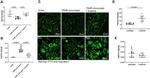 Arginase 1 Antibody in Immunohistochemistry (Paraffin) (IHC (P))