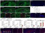 GFAP Antibody in Immunohistochemistry (IHC)