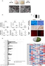 Aggrecan Antibody in Immunohistochemistry (Paraffin) (IHC (P))