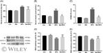 GLUT4 Antibody in Western Blot (WB)