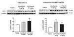 GLT-1 Antibody in Western Blot (WB)