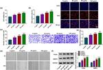 MMP2 Antibody in Western Blot (WB)