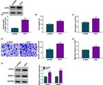 MMP2 Antibody in Western Blot (WB)